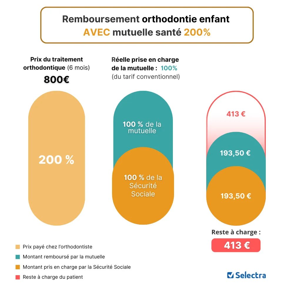 Remboursement orthodontie enfant avec mutuelle 200 %