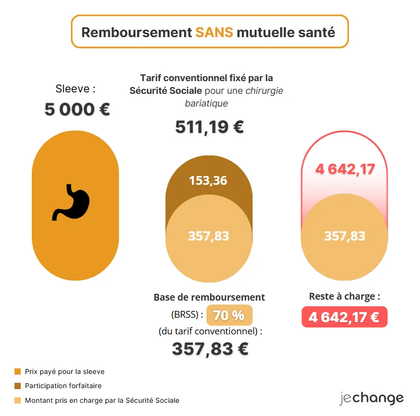 Schéma du remboursement d'une sleeve à 5 000 € par la Sécurité sociale sans mutuelle